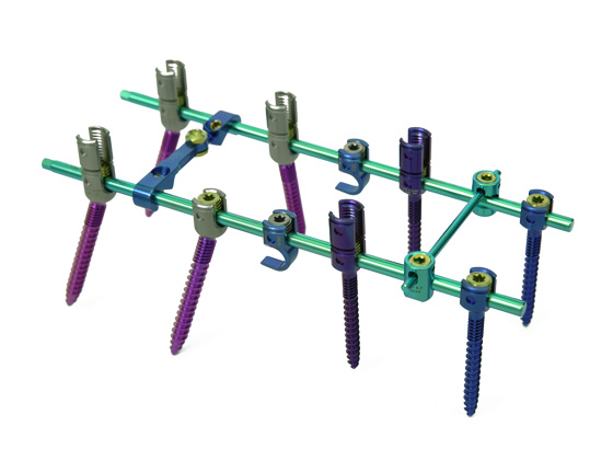 脊柱后路5.5釘棒系統(tǒng)